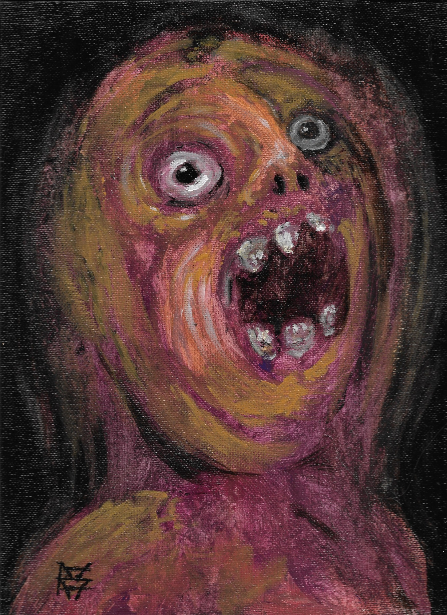 Haemmorhoid Agony Face image