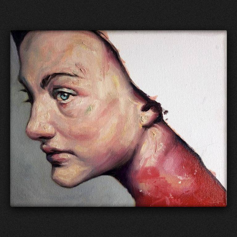 The Birthmark The Birthmark image